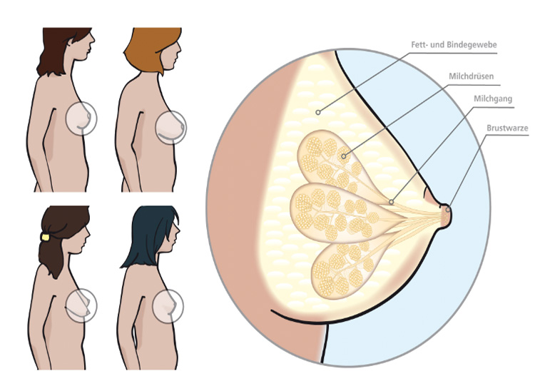 Die weibliche Brust (Quelle: BIÖG) Grafik zeigt 4 unterschiedliche Brustformen. An einer Querschnitt-Grafik wird der anatomische Aufbau einer Brust gezeigt.