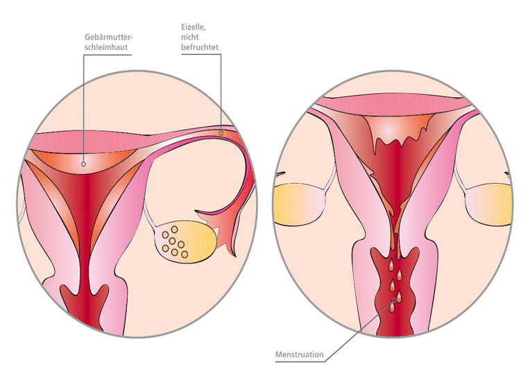 Menstruation (Quelle: BIÖG) Grafik zeigt in einer ersten Abbildung die unbefruchtete Eizelle im Eierstock. In einer zweiten Abbildung setzt die Menstruation ein.