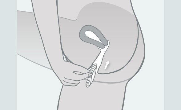 (Quelle: BIÖG) Zum Einführen des Diaphragmas muss beim ovalen Modell der kleine Pfeil auf dem Rand auf Ihren Körper zeigen. Das runde Modell hat keine Markierung. Führen Sie das Diaphragma mit der hohlen Seite nach oben in die Vagina ein.