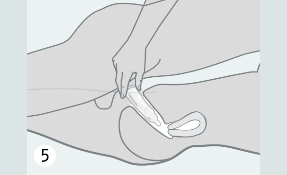 (Quelle: BIÖG) Warten Sie nach dem Sex nicht, bis der Penis weich geworden ist. Halten Sie das Kondom beim Zurückziehen am Penis fest, damit es nicht abrutscht.